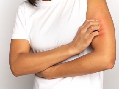 Kosmetyki hypoalergiczne – must have dla skóry wrażliwej